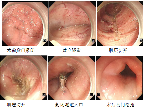 QQ圖片20230607102840.png QQ圖片20230607102840.png