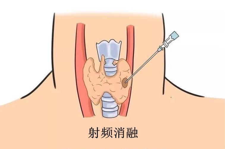 圖片1.png 圖片1.png